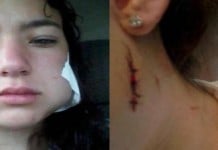 Apuñaló a su novia y estuvo preso 2 horas