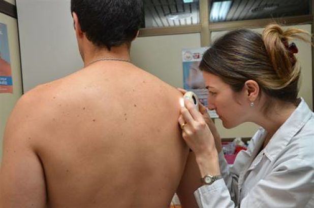 cancer de piel 1_opt