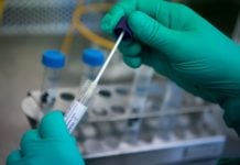 Con 675 casos confirmados, la zona norte concentra la mayor cantidad de personas con covid 19 de la provincia Coronavirus (1)