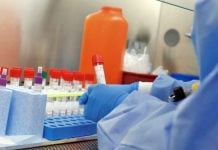 Confirmaron 6 nuevos casos de coronavirus en Pilar y ya suman 27 vecinos con la enfermedad Coronavirus Positivo 9