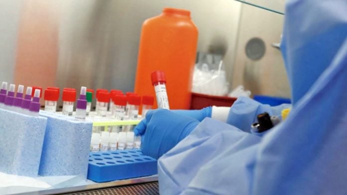 Coronavirus Positivo 9