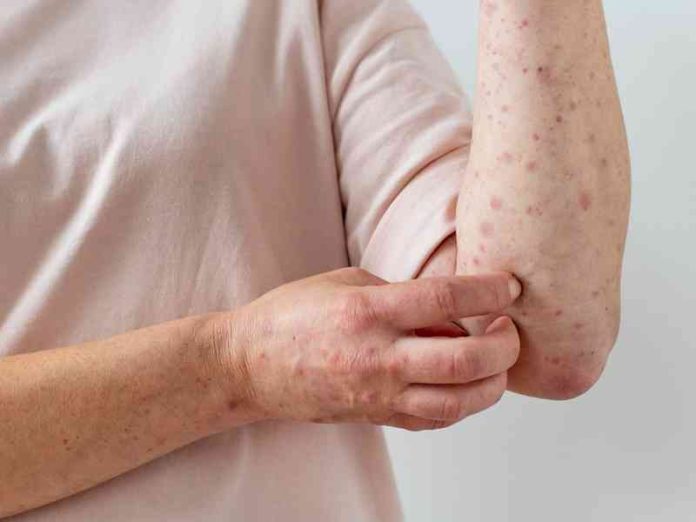 skin allergy on person s arm skin allergy on person s arm