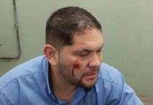 Un colectivero fue agredido en un asalto en Moreno c3aa668360b311e42540f9fdad0dd95e m