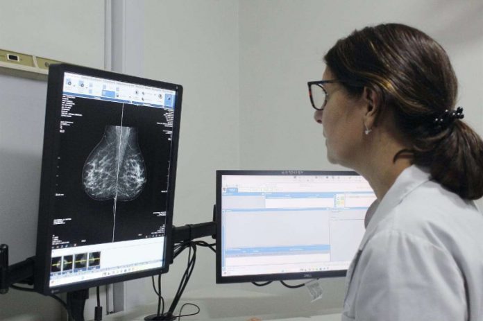 mamografía-estudio-cancer-mama