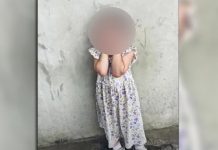 Un patrullero atropelló a una nena de 2 años: está internada en grave estado